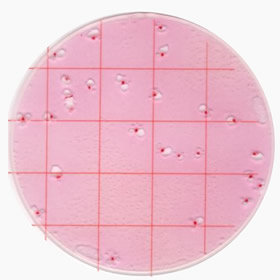 Enterobacteriaceae Count Plate