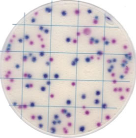 Placa pivotante de recuento de E. coli/coliformes